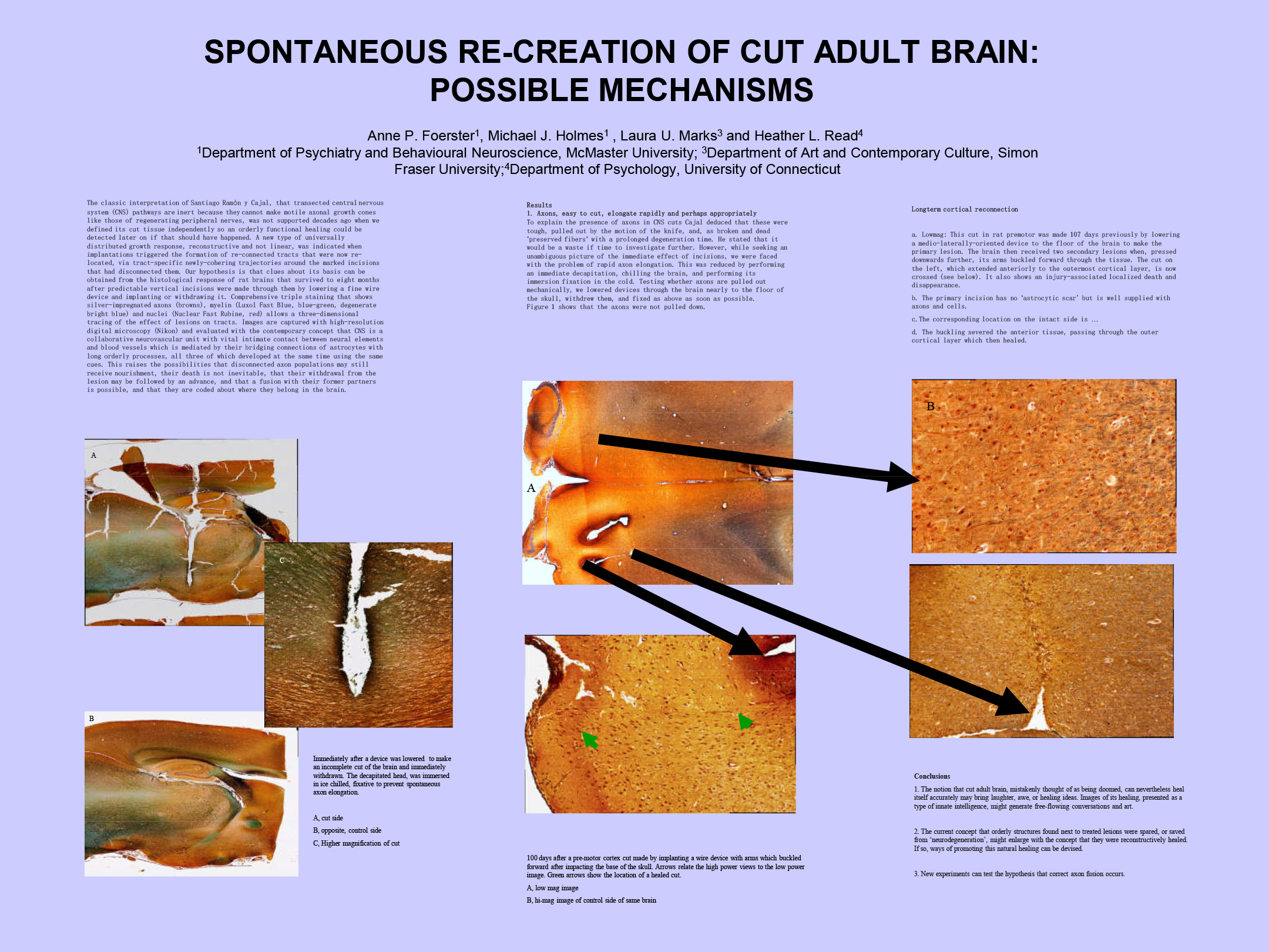 Poster - Foerster Spontaneous Recreation of Cut Adult Brain edit.jpg